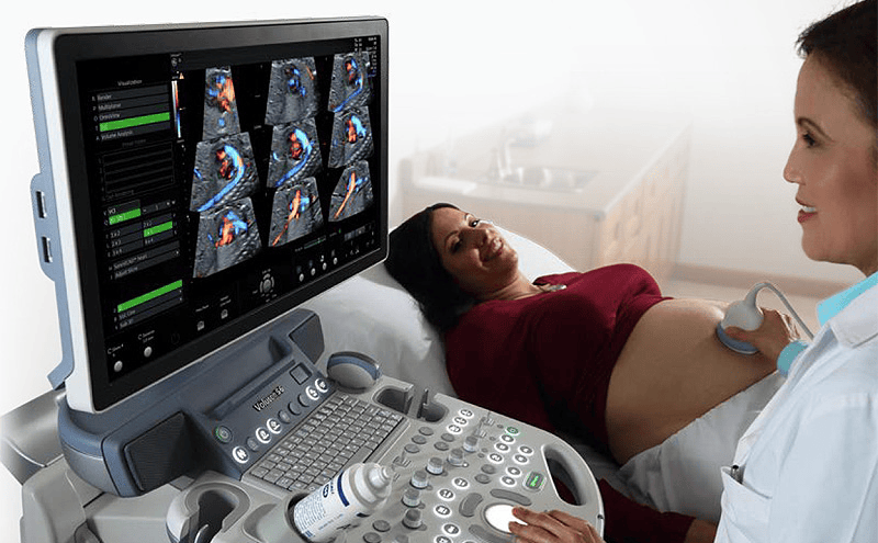 Fetal echocardiography showing detailed heart structure